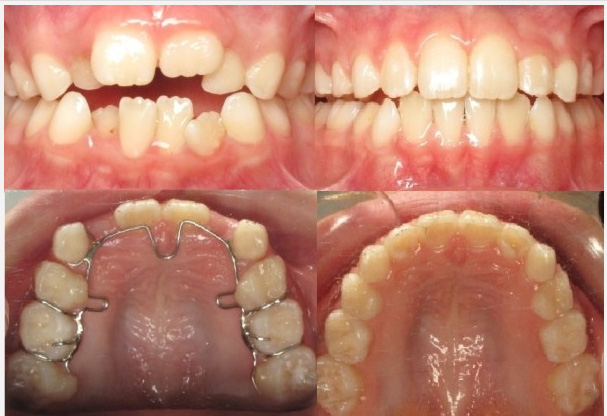 Dynamic Dental Wellness | Frenectomy, Emergency Treatment and Airway Improvement