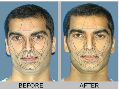 Dynamic Dental Wellness | Nutritional Assessment, Cold Sores  amp  Canker Sores and Airway Improvement