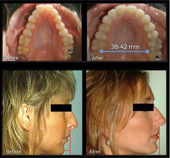 Dentist in Ashburn VA