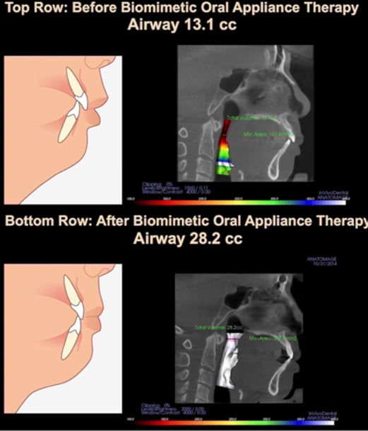 Dentist in Ashburn VA | Laser Dentistry, Emergency Treatment and Take Home Sleep Study