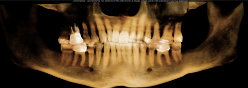 Dynamic Dental Wellness | Take Home Sleep Study, Laser Dentistry and Cosmetic