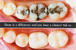 Safe Mercury Removal in Ashburn VA