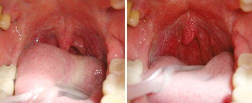 Dentist in Ashburn VA