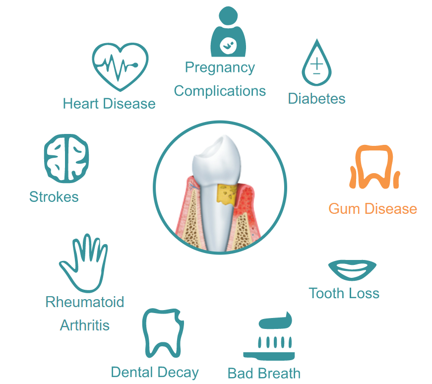 Dentist in Ashburn VA | Laser Cavity Finder, Periodontal Therapy and TMJ Therapy