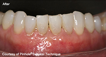 Dentist in Ashburn VA | Cold Sores amp Canker Sores, Nasal Breathing Program and Toothaches