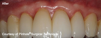 Dentist in Ashburn VA | Sleep Apnea Solutions, Sedation Dentistry and Airway Improvement