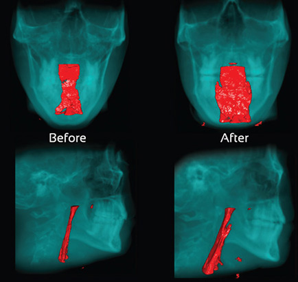 Dentist in Ashburn VA | Toothaches, Sleep Apnea Solutions and Cosmetic Dentistry