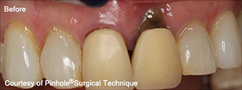 Dentist in Ashburn VA | Periodontal Therapy, Oral Cancer Screening and Low Level Laser Therapy