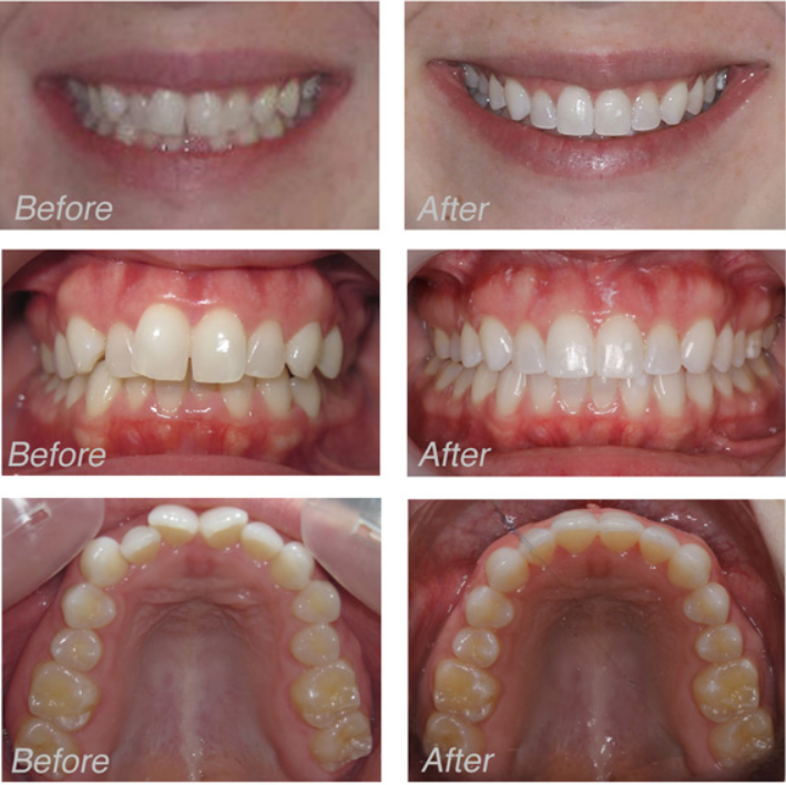 Dentist in Ashburn VA | Sleep Apnea Appliances, Biomimetic Dentistry and Laser Cavity Fix