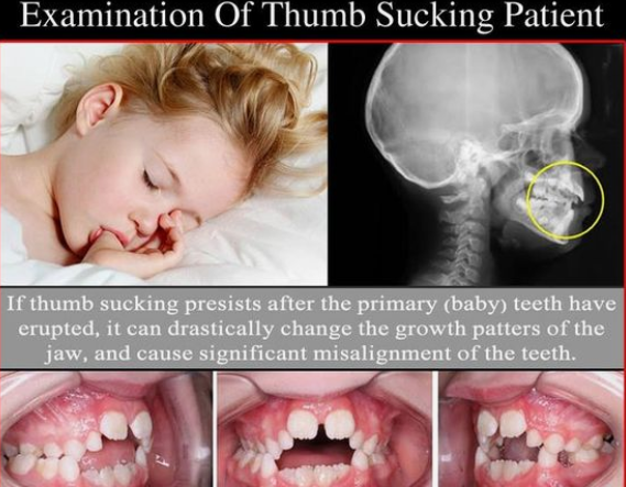 Dentist in Ashburn VA | Biocompatability Testing  amp  Dental Toxicity, Laser Cavity Fix and Low Level Laser Therapy