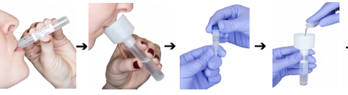 Dentist in Ashburn VA | Emergency Treatment, Biocompatability Testing  amp  Dental Toxicity and Oral DNA Testing