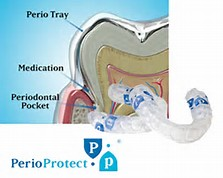 Dentist in Ashburn VA | Biocompatability Testing  amp  Dental Toxicity, Green CT and Laser Cavity Fix
