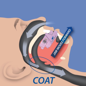 Dentist in Ashburn VA | NuCalm reg , Biocompatability Testing amp Dental Toxicity and Dental Implants
