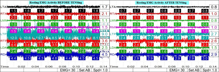 Dentist in Ashburn VA | Laser Cavity Fix, Sleep Apnea Appliances and Nu Calm reg 