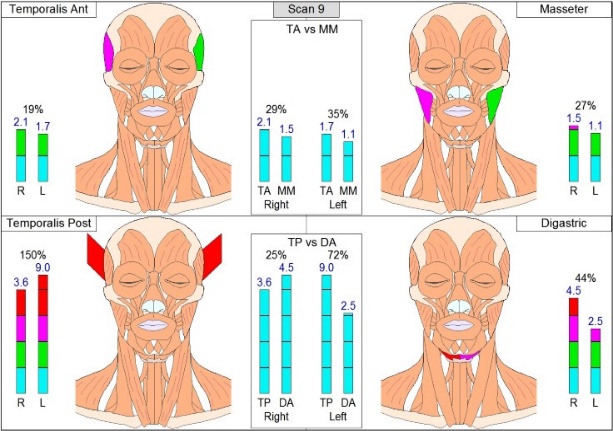 Dentist in Ashburn VA | Orthodontics, NuCalm reg  and Emergency Treatment
