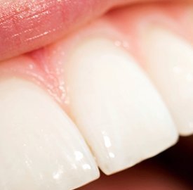 Dentist in Ashburn VA | Take Home Sleep Study, Oral Cancer Screening and Nu Calm reg 