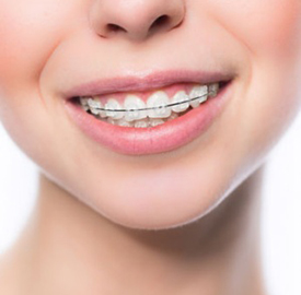 Dentist in Ashburn VA | Cold Sores  amp  Canker Sores, Orthodontics and Dental Implants