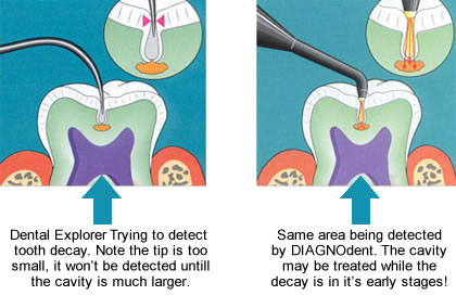 Dentist in Ashburn VA | Cold Sores  amp  Canker Sores, Cosmetic and Recession Treatment