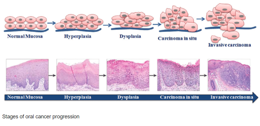 Dentist in Ashburn VA | Emergency Treatment, Biocompatability Testing  amp  Dental Toxicity and Oral DNA Testing