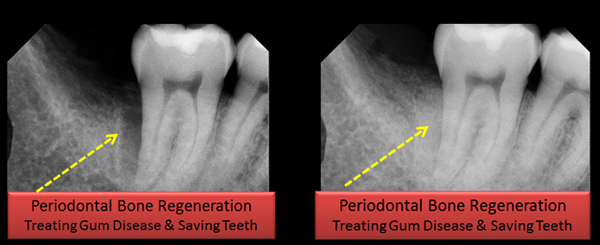 Dentist in Ashburn VA | Take Home Sleep Study, Sedation Dentistry and Early Orthodontics
