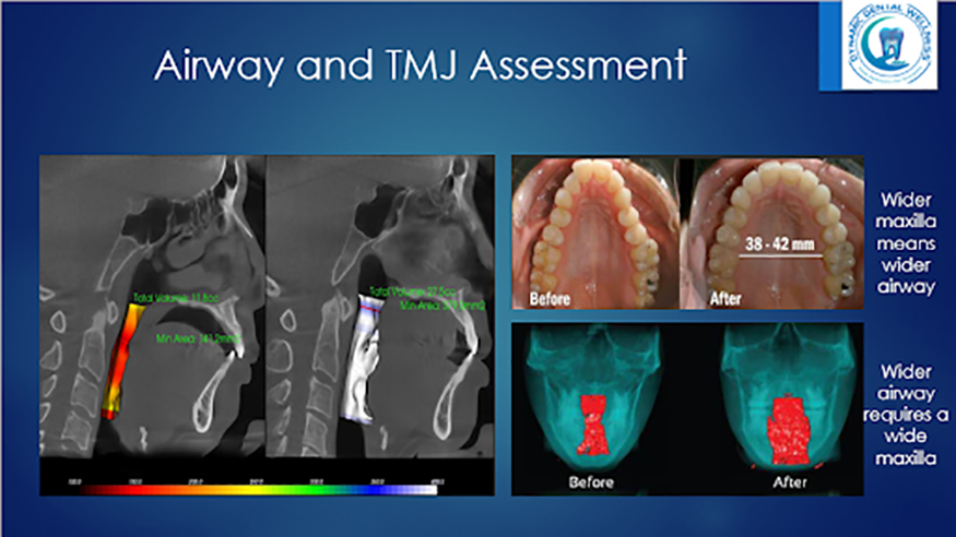 Dynamic Dental Wellness | Nu Calm reg , Soft Tissue Laser and Alternatives to Orthodontics